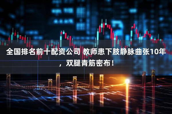 全国排名前十配资公司 教师患下肢静脉曲张10年，双腿青筋密布！